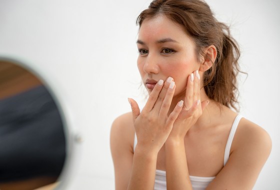 The best ways to treat heat rash in summer